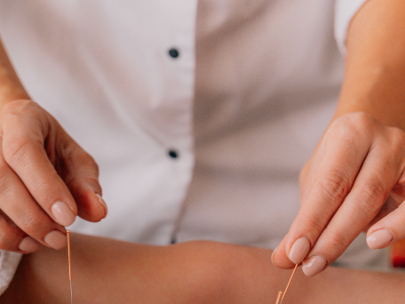 Acupuncture treatment in Central New Jersey for natural pain and allergy relief
