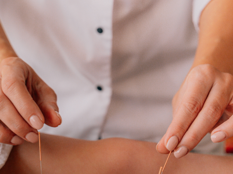High Stress, Cortisol, and Weight Gain: How Acupuncture Helps with Natural Weight Loss