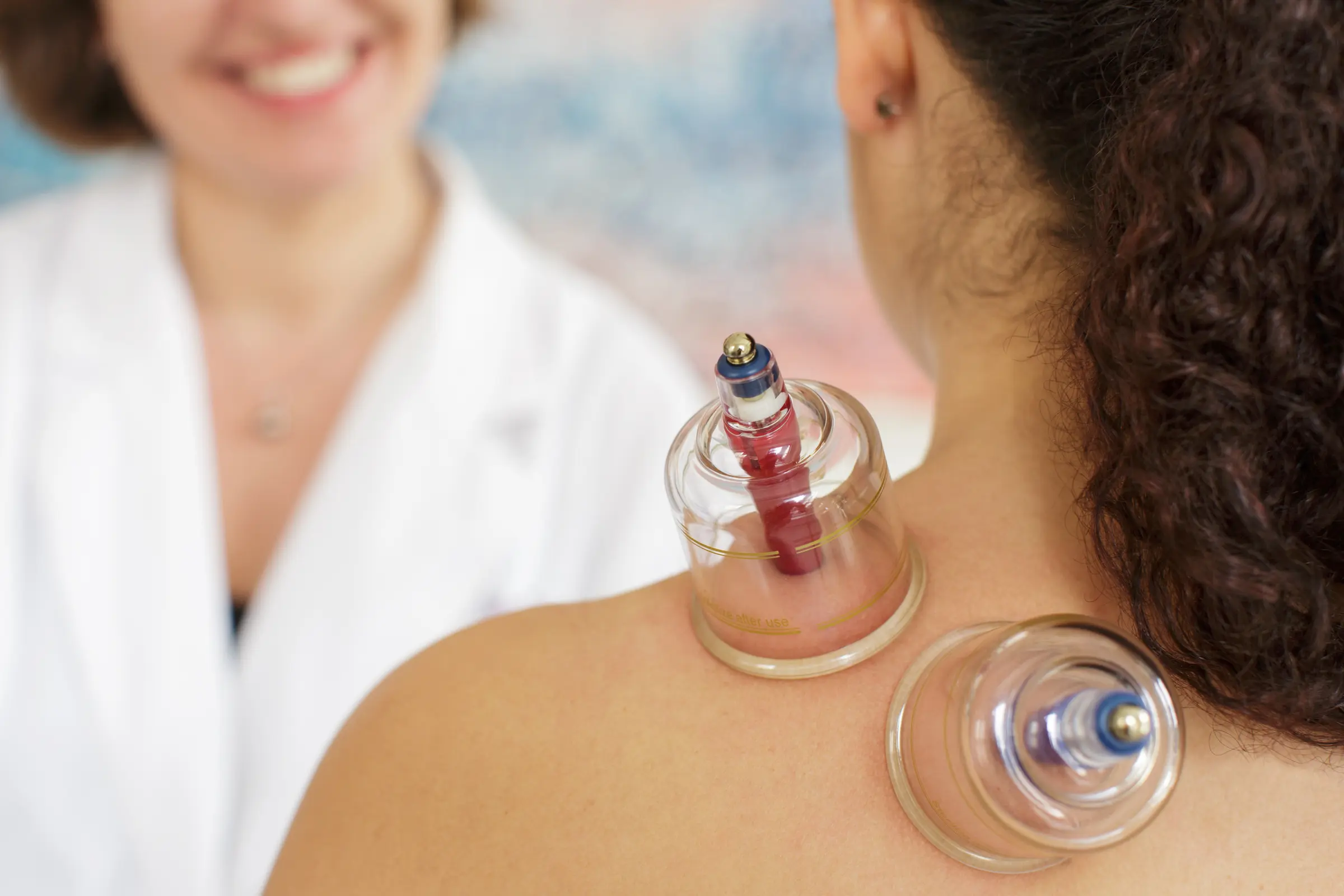 Cupping Therapy