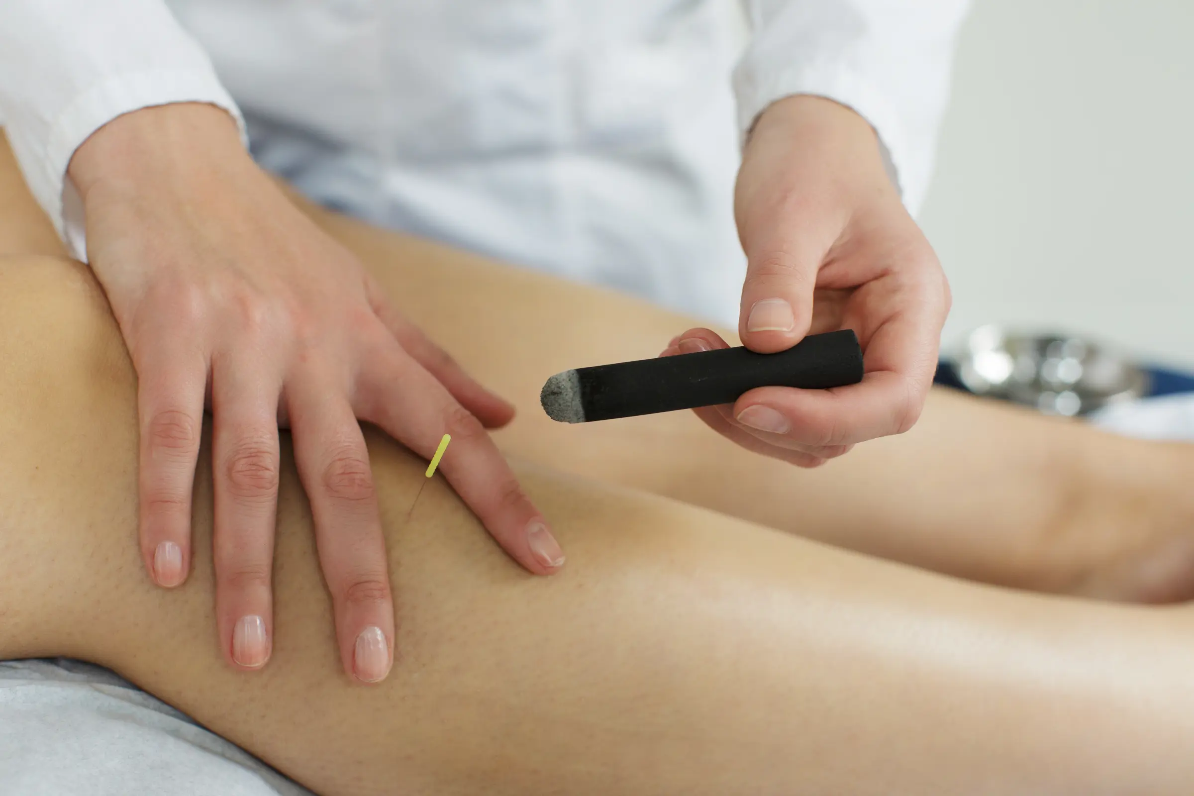 Moxibustion