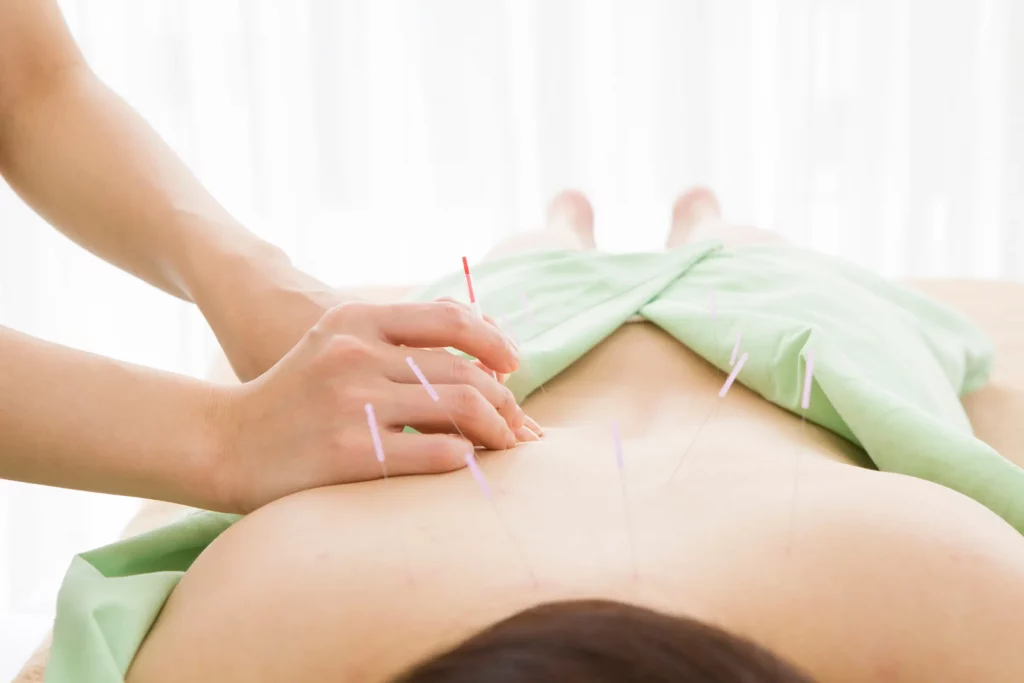 Acupuncture treatment for back pain relief in Freehold NJ